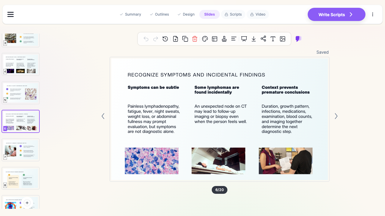 ChatSlide editor showing a lymphoma slide on symptoms and incidental findings, with histology, CT imaging, and clinic images