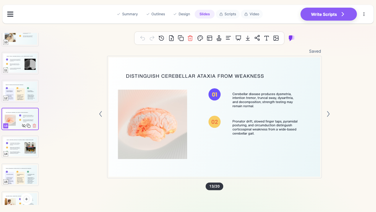 ChatSlide slide editor showing a generated pediatric neurology teaching slide distinguishing cerebellar ataxia from corticospinal weakness, with a brain image